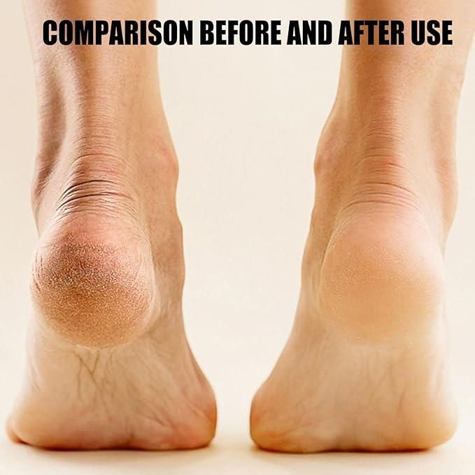 π
Electronic Pedicure Tool